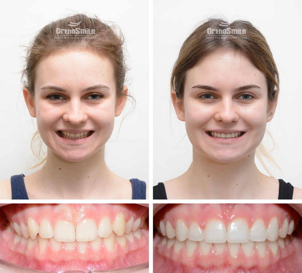 ortodonta wrocław ortho smile orthosmile